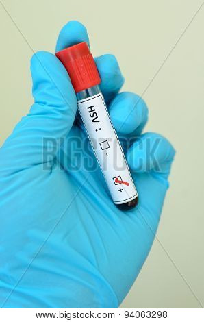 Herpes positive