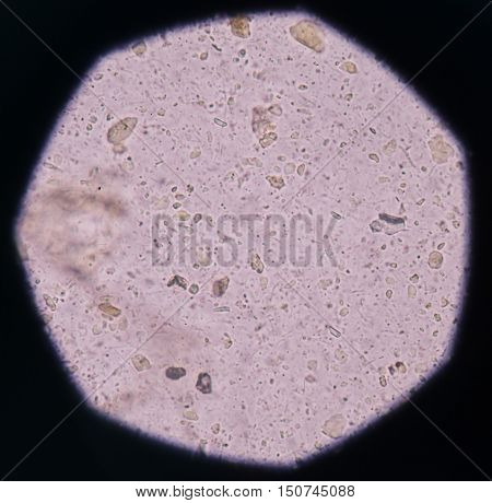 Bacteria in Urinary Tract Infections find with microscope.