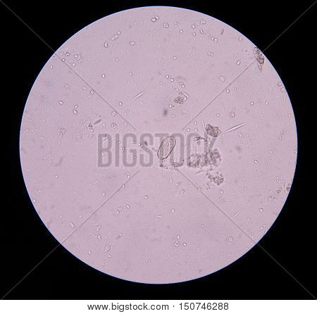 eggs of Capillaria philippinensis in fecal concentrate.