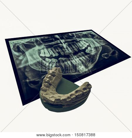Vintage Looking Xray Of Teeth With Positive Teeth Cast
