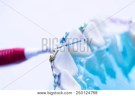 Interdental Teeth Brackets Clean