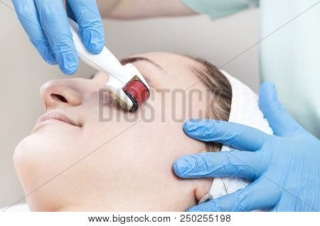 The Woman Undergoes The Procedure Of Medical Micro Needle Therapy With A Modern Medical Instrument D