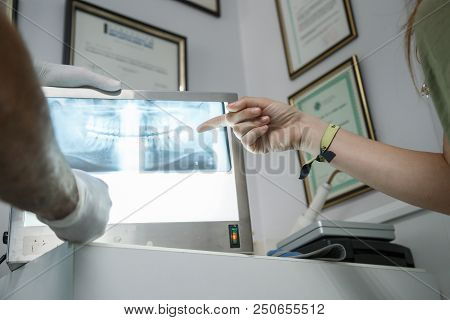 Young Woman Looking At The X-ray Of Her Mouth While The Dentist Explains To Her At The Dental Clinic