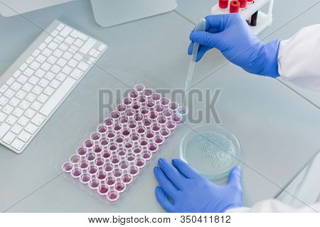 From above shot of unrecognizable pharmacologist examinig chemical reaction of new medicament