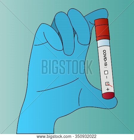 Diagnostics passed. The blood sample is positive. Coronavirus infection COVID-19 detected. Vector illustration. Isolated green background. Test tube with patient analysis in the hands of a laboratory assistant. Medical concept. Collection of clinical samp