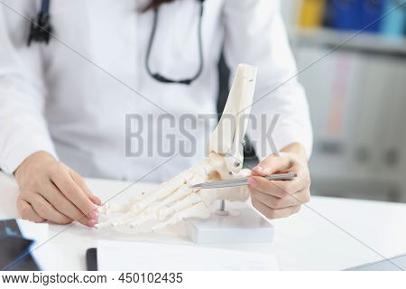 Close-up Of Orthopedic Doctor Show Human Plastic Feet Model, Analyzing Every Bone And Toe. Medicine,