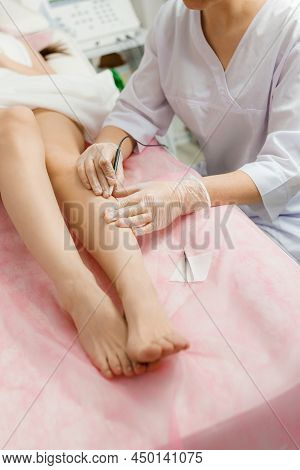 Dermatologist Doing Hair Removal Treatment On Patients Leg With Electrolysis. Depilation And Beauty 