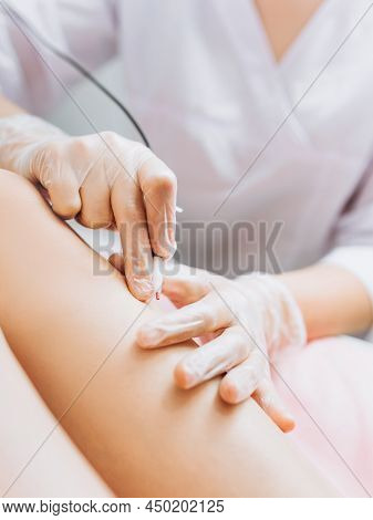 Dermatologist Doing Hair Removal Treatment On Patients Leg With Electrolysis. Depilation And Beauty 