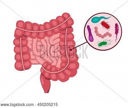 Human Small And Large Intestine And Intestinal Bacteria. Microflora, Viruses Insidethe Internal Orga