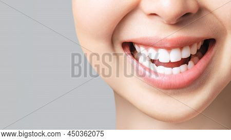 Perfect Healthy Teeth Smile Of A Young Asian Woman. Teeth Whitening. Dental Clinic Patient. Image Sy
