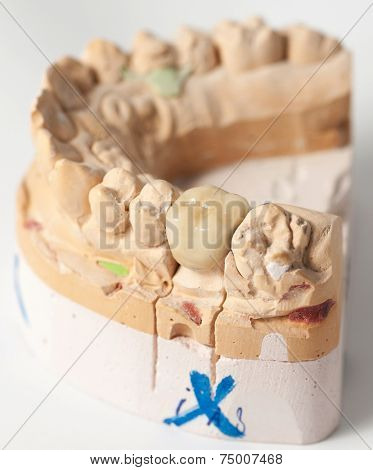 Technical shots on a dental prothetic laboratory