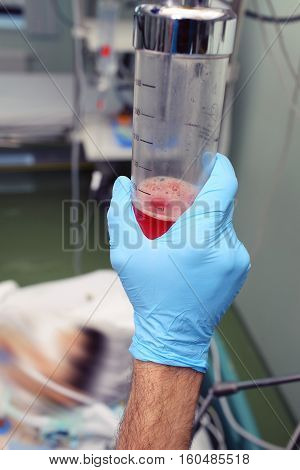 Working with body fluids (biowaste) of patient.