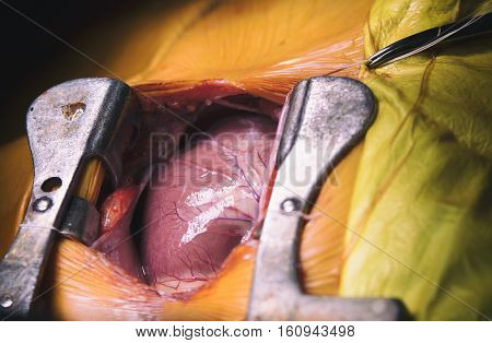 Beating human heart close-up in opened chest during the surgery