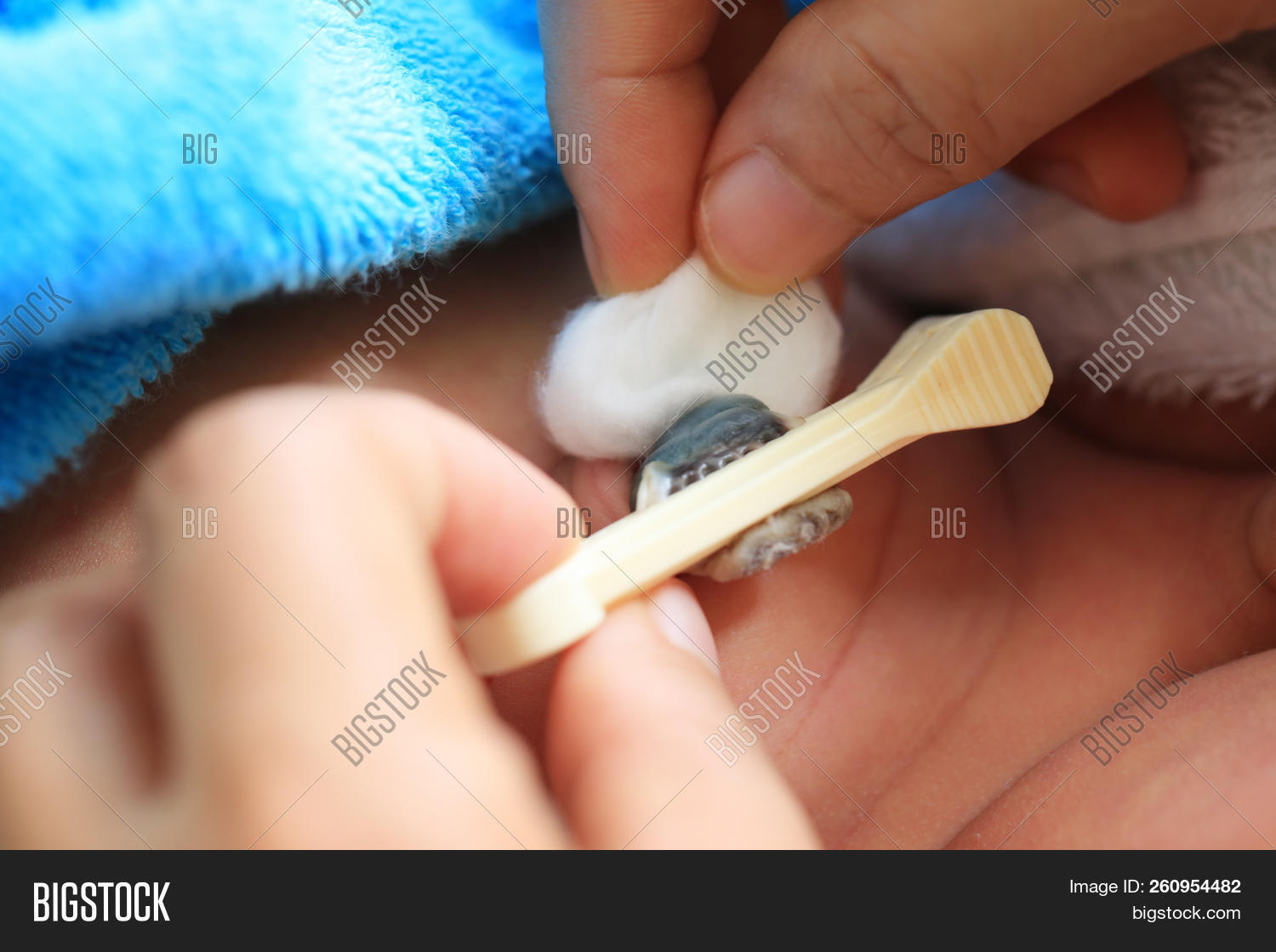Cleaning Umbilical Image & Photo (Free Trial) Bigstock