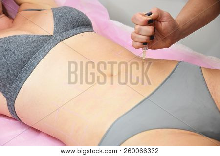 Beauty Injections In The Salon. The Procedure For Skin Tightening And Rejuvenation.