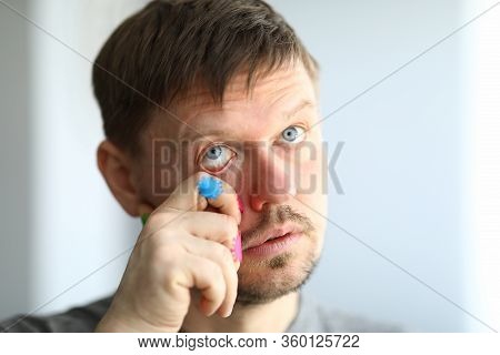 Close-up Of Middle-aged Male Touching Mucous Membranes Of Eye With Dirty Hand. Germs On Persons Skin