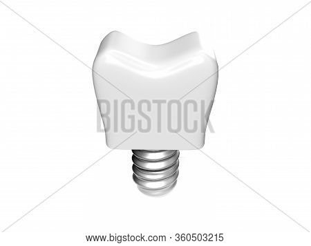 3d Render White Tooth Implant Denture Icon Set Closeup Isolated On White Background. Dental, Medicin