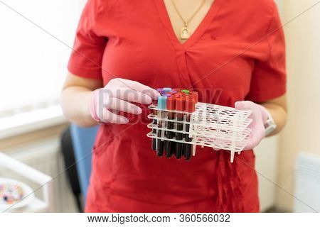 Nurse Arranges Test Tubes With Blood On A Tray. Virus Infection. Pneumonia Testing. Covid-19 And Cor