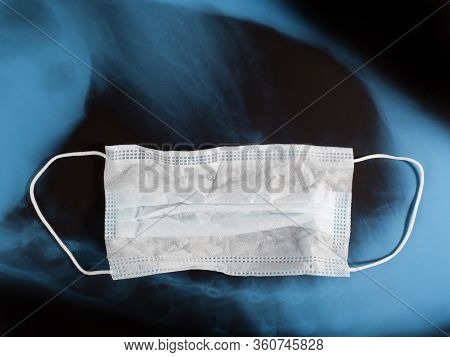 Medical Ear-loop Mask On Blue Black X-ray Image Background. Protection Concept. With Copy Space
