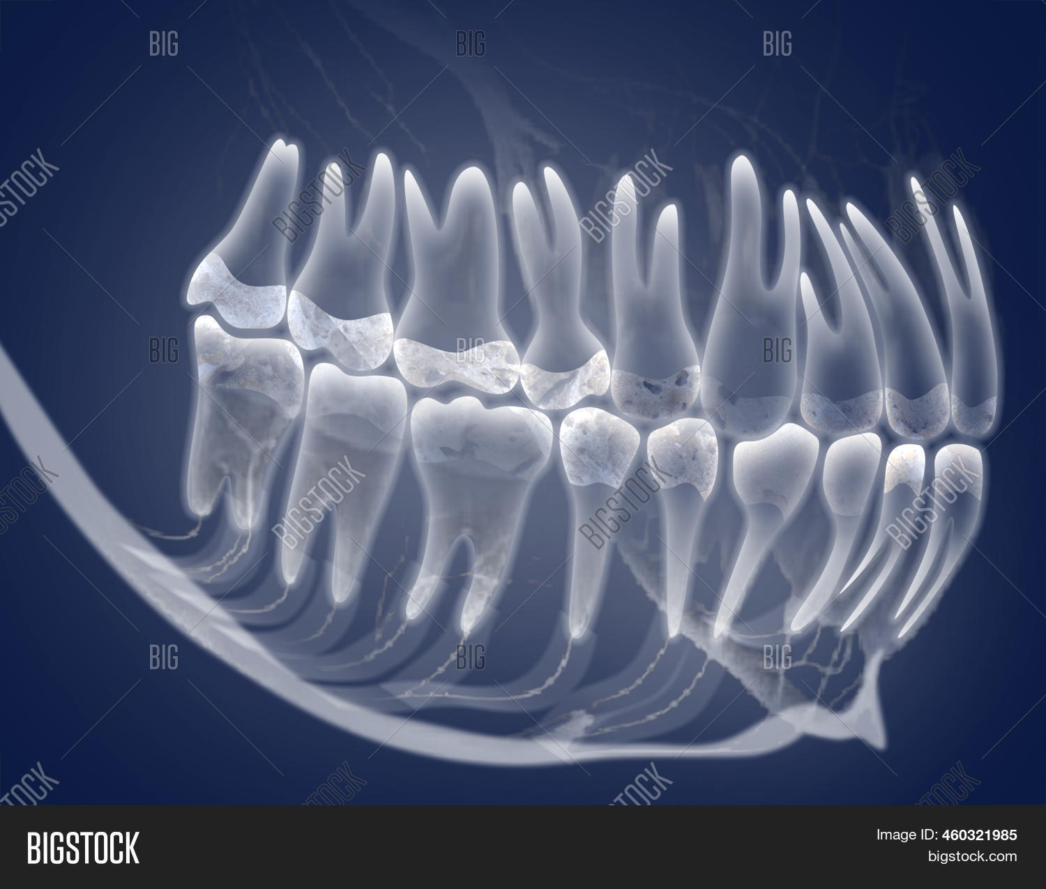 Xray Picture Oral Image & Photo (Free Trial) Bigstock
