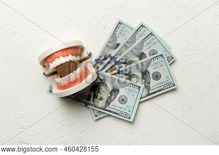 Closeup Model Of A Human Jaw With White Teeth And Dollar Bill. Dentistry Conceptual Photo. Prostheti