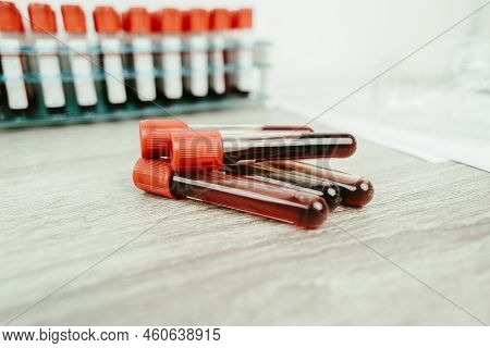 A Blood Test Sample Tube Pile With A Red Cap On Desk In The Hematology Lab,  Hematology Healthcare L