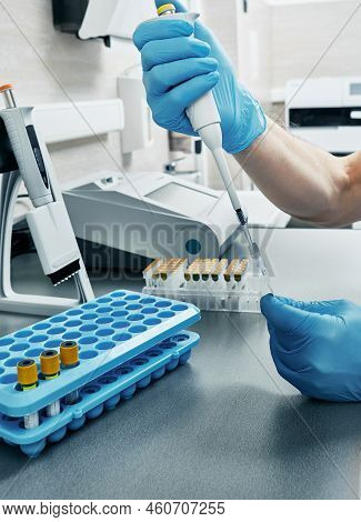 Laboratory Technician With Micropipette For Test Analyzes Determines Persons Blood Type Using Gel Te