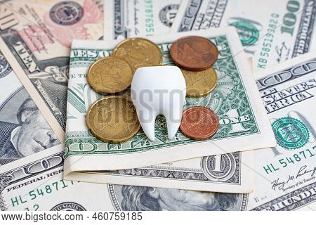 Large White Tooth On A Pile Of Dollar Bills And Euro Coins. Dental Care Expenses Related Background.