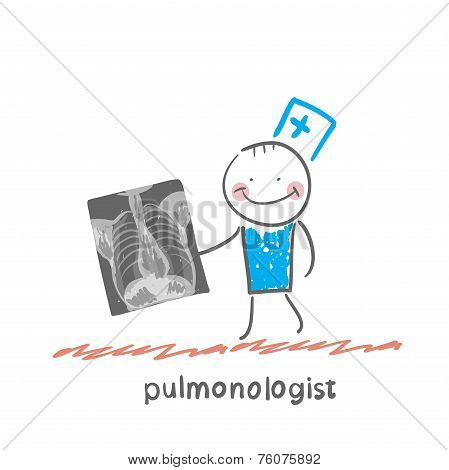 pulmonologist with an X-ray of human lung