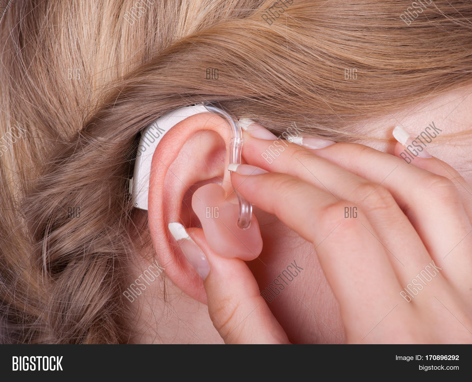 Кохлеарная имплантация презентация. Грэм кларк кохлеарная имплантация. Слуховой опыт. Кохлеарная имплантация cochlear 7. Слуховые аппараты.