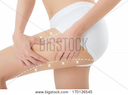 woman grabbing skin on her thigh with the white color crosses marking Lose weight and liposuction cellulite removal concept Isolated on white background.