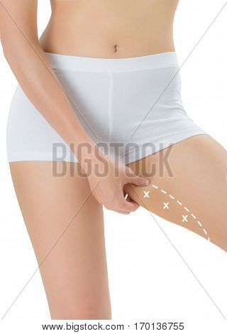 Woman grabbing skin on her Inner thigh with the white color crosses marking Lose weight and liposuction cellulite removal concept Isolated on white background.
