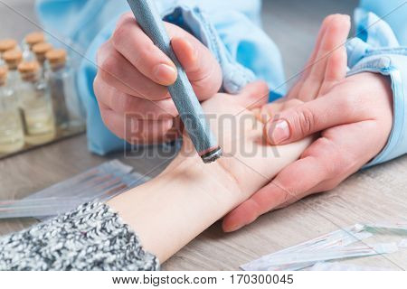 Alternative medicine therapist doing moxa treatment on her client