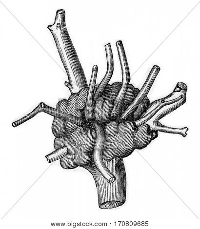 Magnifier produced on Quercus Cerris, at the insertion of an already old foot Loranthus installs parasite., vintage engraved illustration.