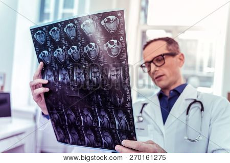 Close Up Of Male Hands That Holding Roentgen Photo