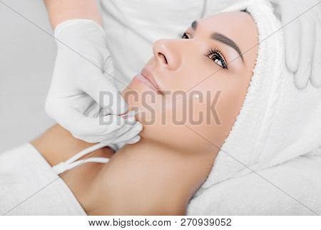 Aesthetic Face Surgery, Cosmetic Technique, Mesothreads Lifting And Contouring Face