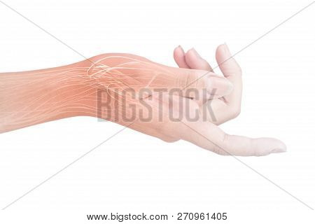 Wrist Muscle Injury White Background Wrist Pain