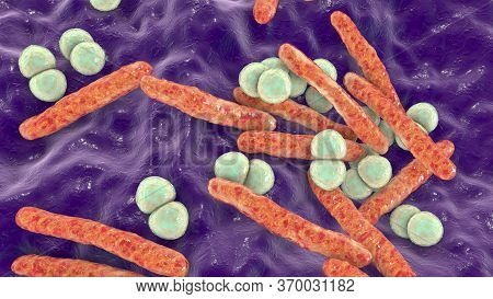 Respiratory Pathogens, Bacteria Mycobacterium Tuberculosis And Streptococcus Pneumoniae, 3d Illustra