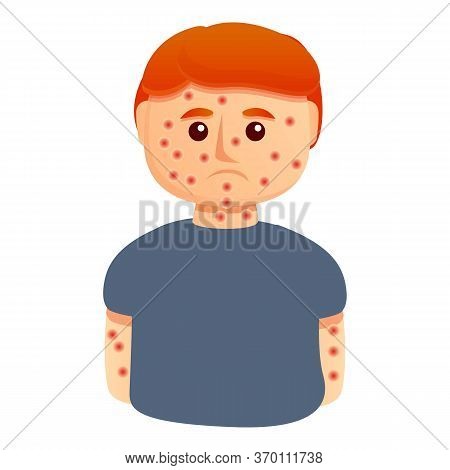 Chicken Pox Boy Icon. Cartoon Of Chicken Pox Boy Vector Icon For Web Design Isolated On White Backgr
