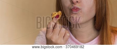 Young Woman With Acne Problem Eating Chocolate Bar And Sweets . Skin Allergy. Concept Of Skin Proble