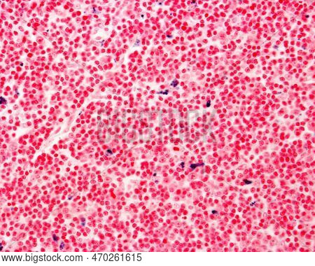 Lymph Node Macrophages Labelled With Trypan Blue