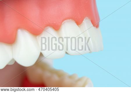 Dental Teeth Model Dentures On Blue Background, Close-up. Dental Model. Close Up Tooth Model Mock To