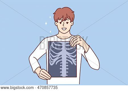 Man Applies X-ray Film To Chest To Prove Absence Of Cancerous Tumor Or Spinal Injury. Guy With X-ray