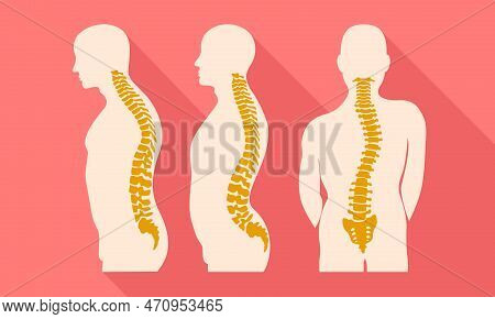 Human Spine Disease Icon. Flat Illustration Of Human Spine Disease Icon For Web Design