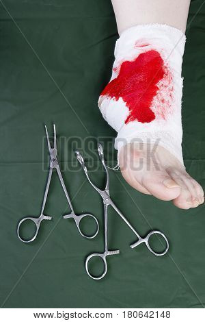 White medicine bandage on human injury foot