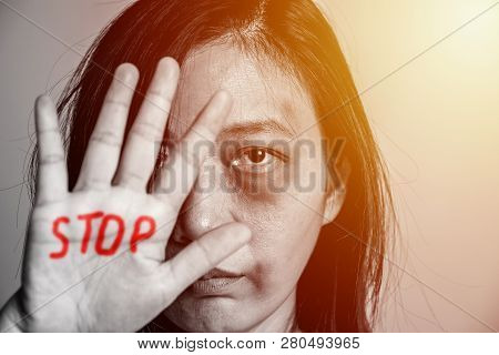 Stop Violence Against Women Campaign. Asia Woman With Bruise On Arms And Face Raised Her Hand For Di