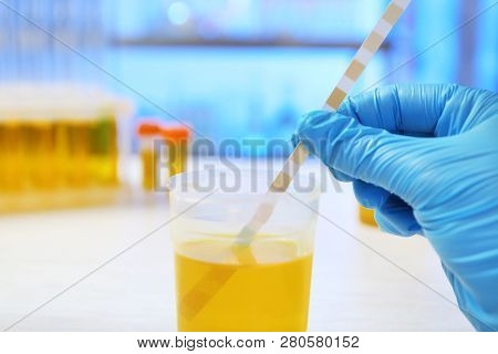Laboratory Assistant Doing Analysis With Urine Sample And Litmus Paper On Table, Closeup