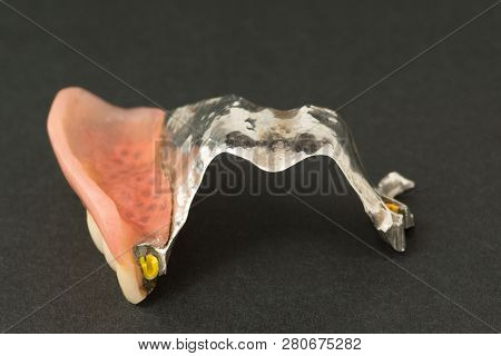 Image Of A Modern Arc  Denture With Attachment On A Black Background