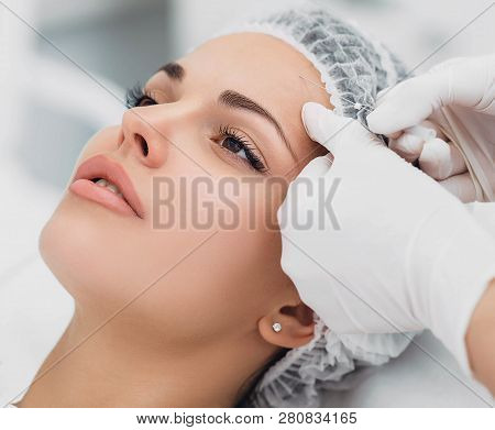 Aesthetic Face Surgery, Cosmetic Technique, Mesothreads Lifting And Contouring Face