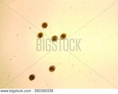 Toxocara Cati Egg Under The Microscope V